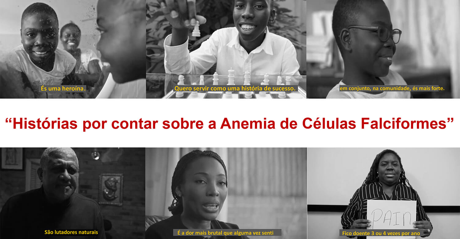Histórias por contar sobre a Anemia de Células Falciformes Histórias por contar sobre a Anemia de Células Falciformes